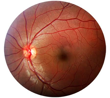Imagen clínica de retina para diagnóstico oftalmológico